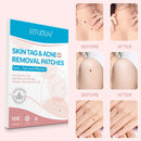Acne Skin Tag Remover Beauty Acne Patch Wart Removal Stickers Removal Care Invisible Blackhead Skin Patch